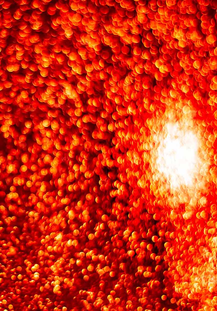 Recent Advancements in Optical Coherence Tomography | IntechOpen